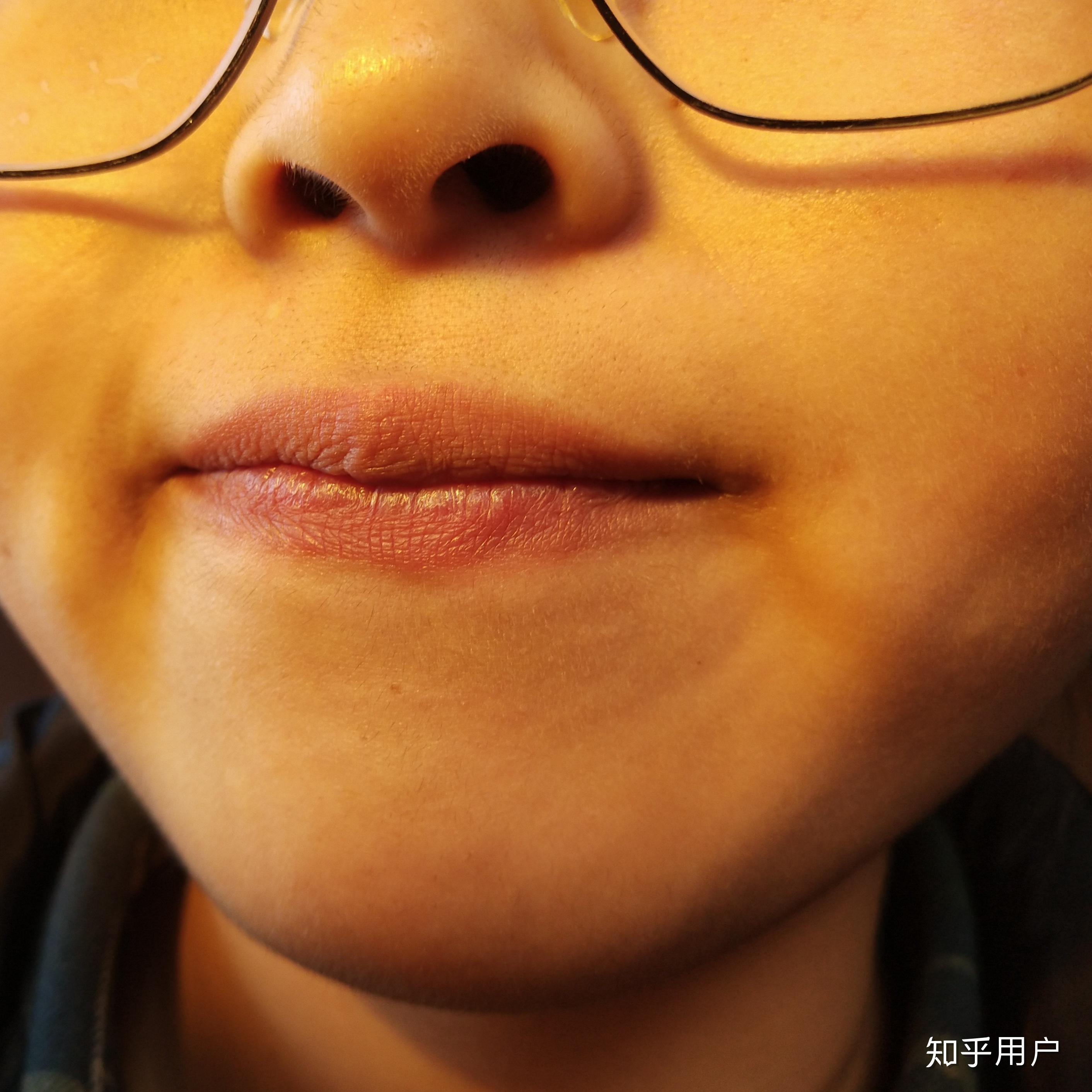 女生唇毛重鼻毛长该怎么办