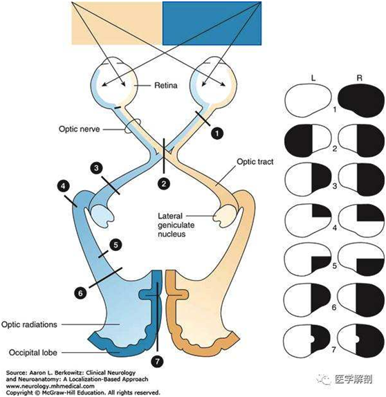你看到的东西都是反的么