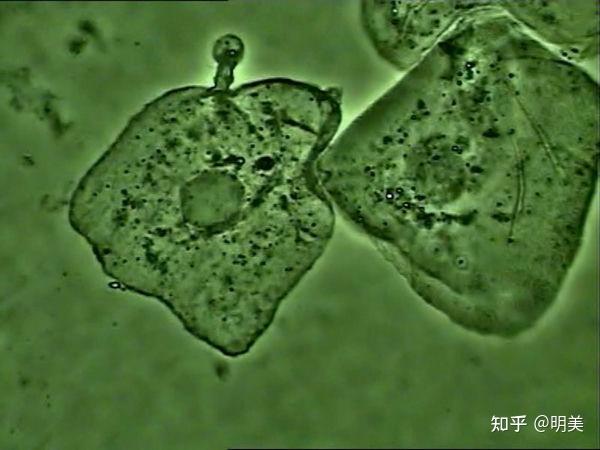 显微镜下的肺炎支原体 - 知乎