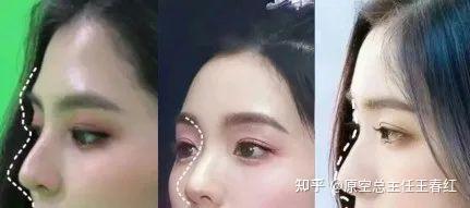 眉弓怎么打显高级?剂量不是越多越好,先看骨相再定量 - 知乎
