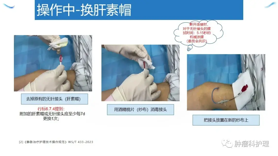 【PPT】经外周静脉置入中心静脉导管(PICC)的规范化维护 - 知乎