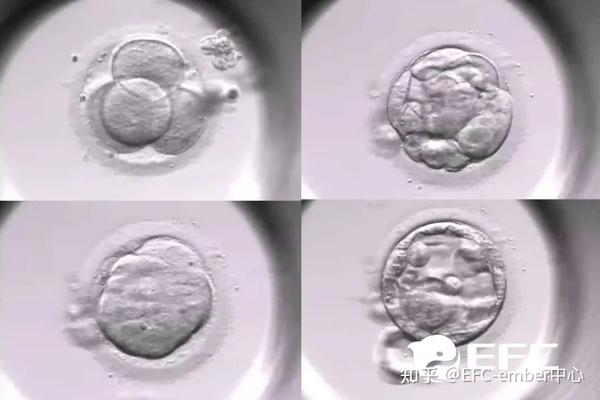 美国EFC试管科普|囊胚等级怎么看?3步读懂胚胎等级报告 - 知乎