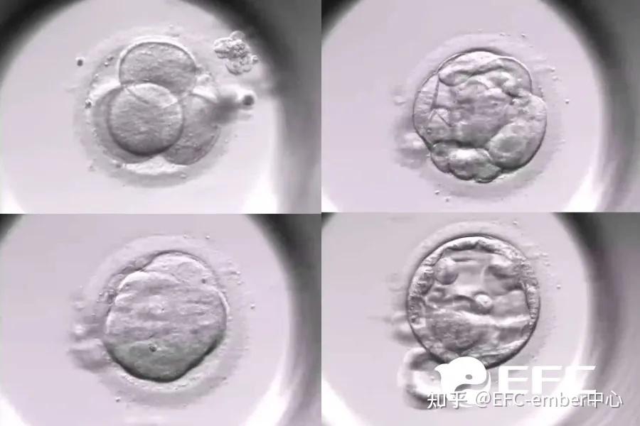 美国EFC试管科普|囊胚等级怎么看?3步读懂胚胎等级报告 - 知乎