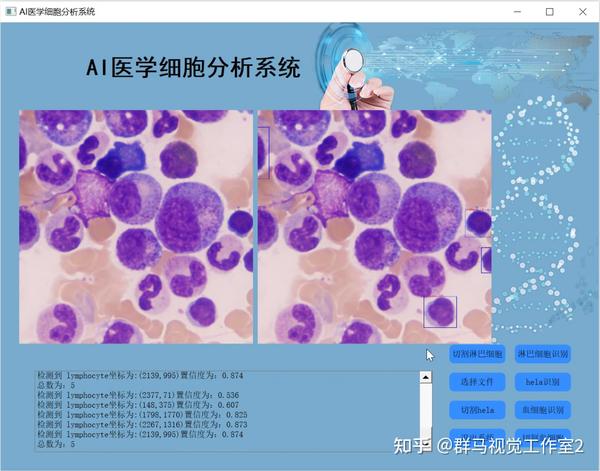 python api 作成 – python api 構築 , chatgpt... Python基于YOLOv7的显微镜下细胞识别&分割系统(源码&部署教程&数据集) - 知乎