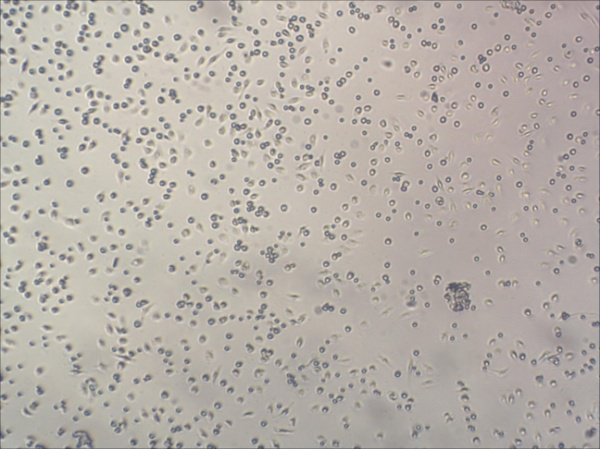 小鼠巨噬细胞的原代培养