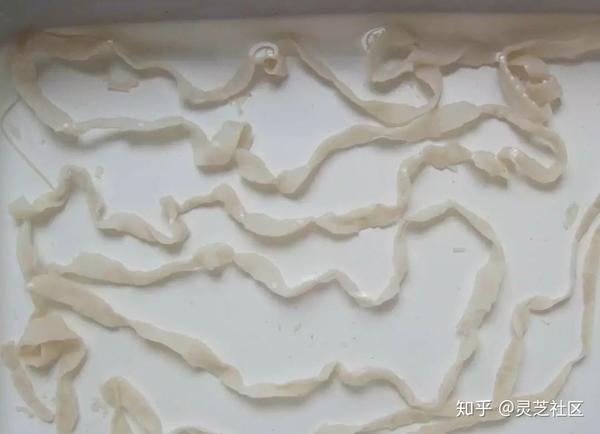 如果体内有寄生虫 自己能感觉出来吗 是时候跟你讲明白了 知乎