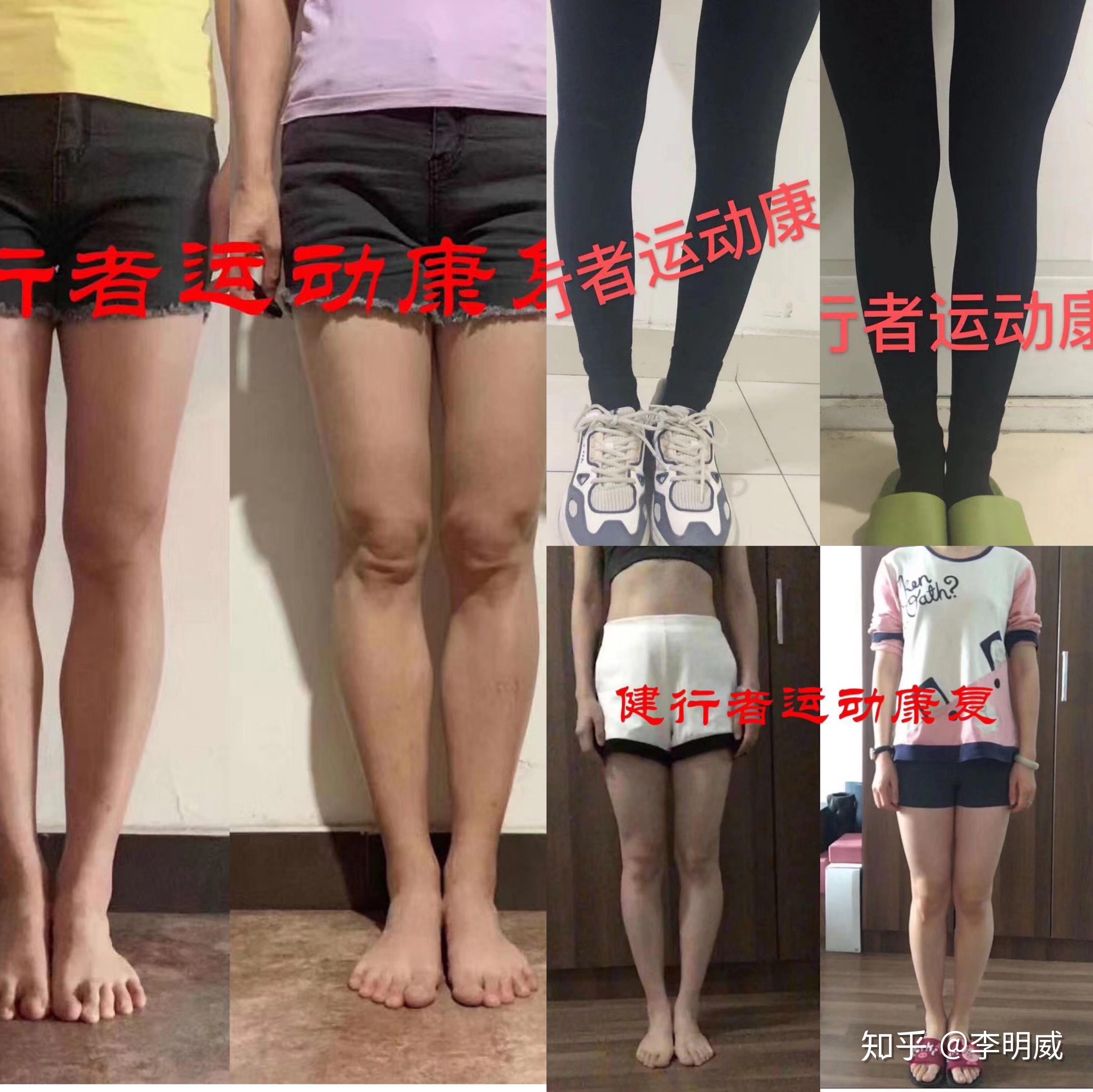 v2-723337a28d0f1de37bf688e67b99d18e_r.jpg