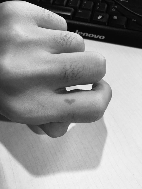 会啊   手指内侧有一个