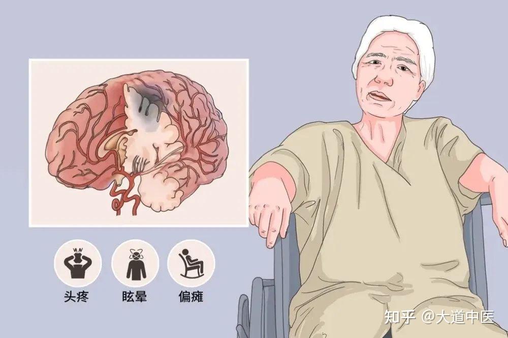 醒脑开窍针刺法 中风患者的福针 - 知乎