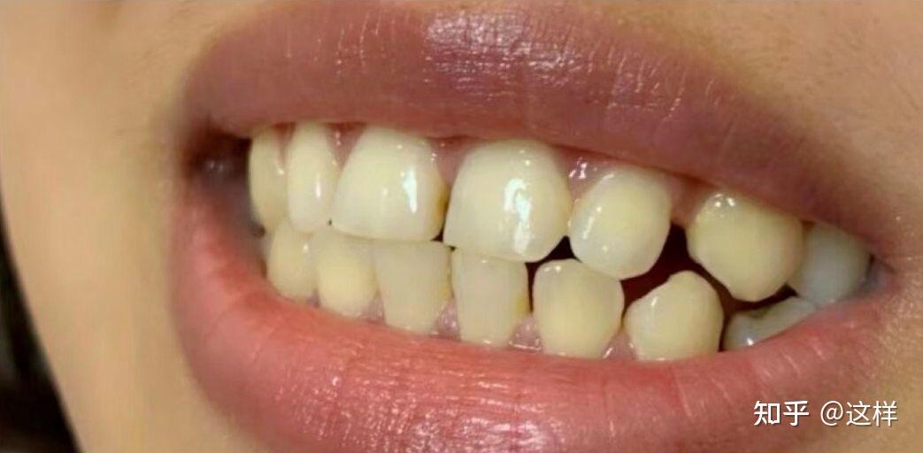 牙黄分几种图片
