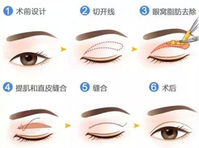 v2-736dac29b44036e6a0ba3831418d82df_1440w.jpg?source=172ae18b