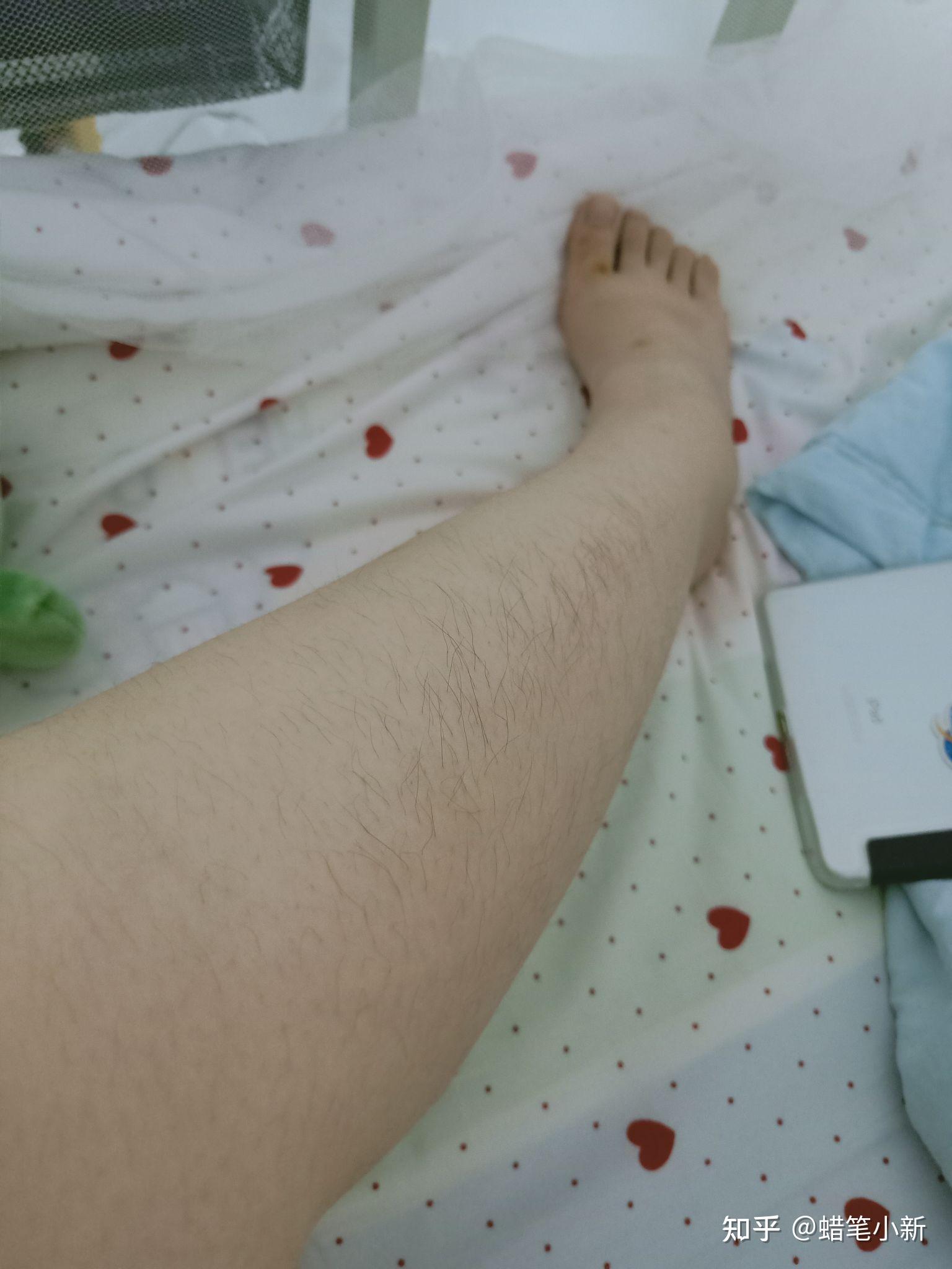 用完身体乳长腿毛! - 知乎