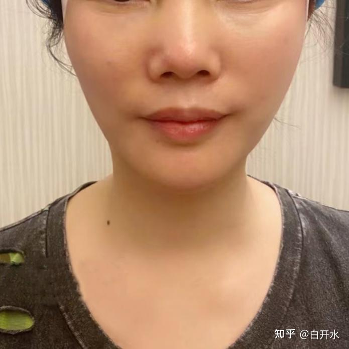 30分钟解决面部松垮问题 - 知乎