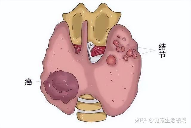 “个性”中药【夏枯草】:专攻肝火引起的【目珠疼痛,痰饮症】 - 知乎