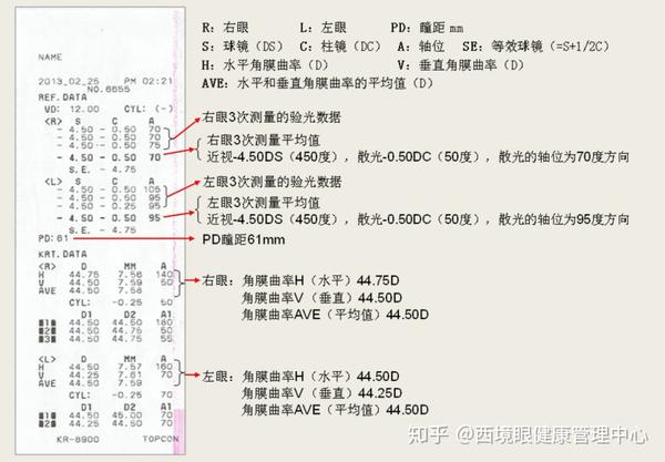 一秒钟教你读懂配眼镜的验光单,做到心中有数