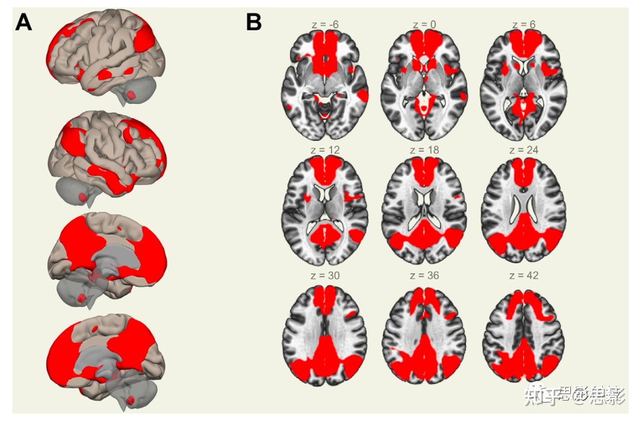 自闭症和注意缺陷多动障碍默认模式网络的周期性动态改变 - 知乎