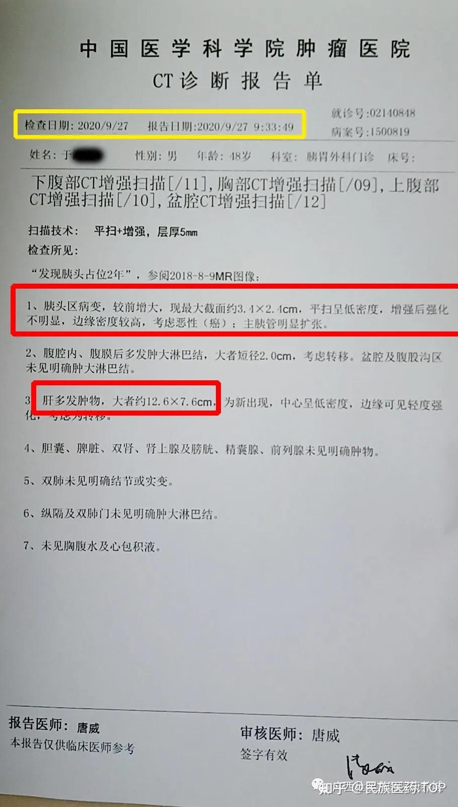 病例追踪抗癌壮药金草消毒颗粒让晚期胰腺癌肝转移患者转危为安