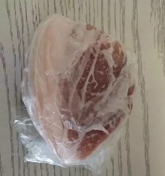 拔牙是一种什么体验?拔牙不镶牙不种牙又是一