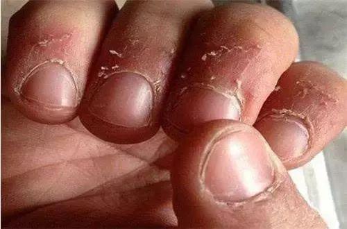 啃指甲吃手咬铅笔孩子小动作背后暗藏心理问题要警惕