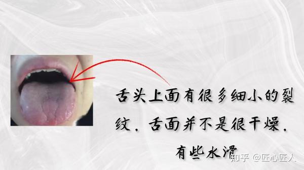 肾虚不虚,舌象告诉你! - 知乎