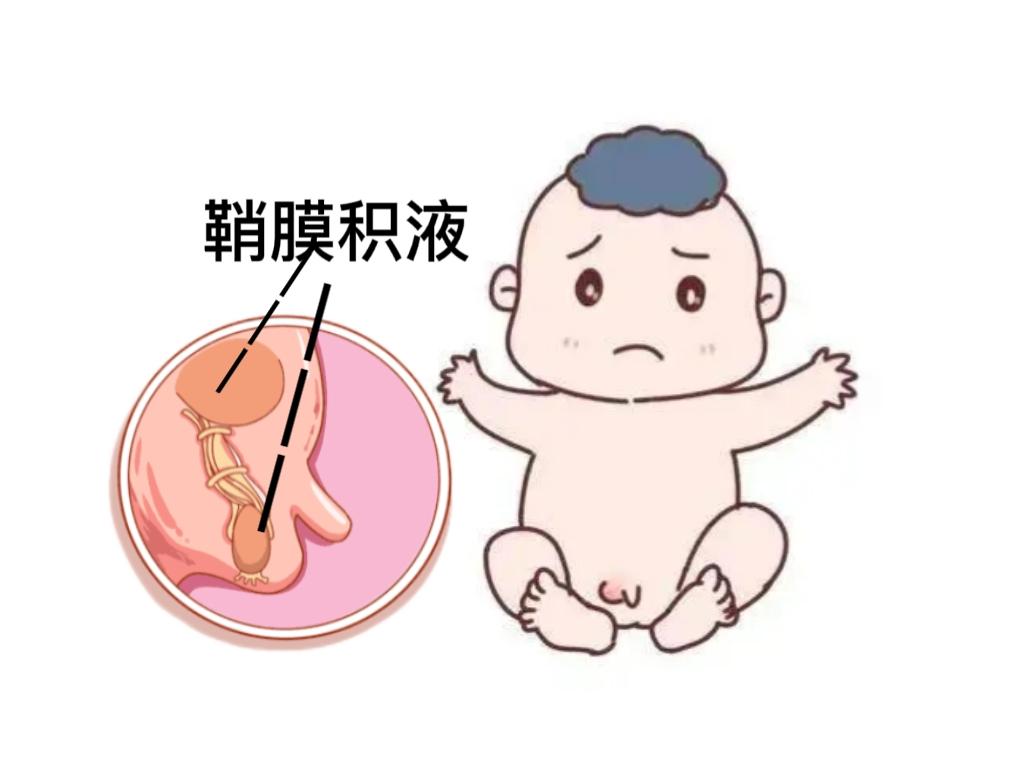 三个月男宝宝睾丸图片图片