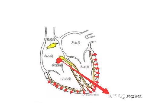 如何看懂心电图？ - 知乎
