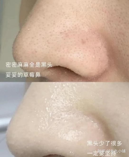 经期护肤保养_如何护肤保养_护肤保养图片