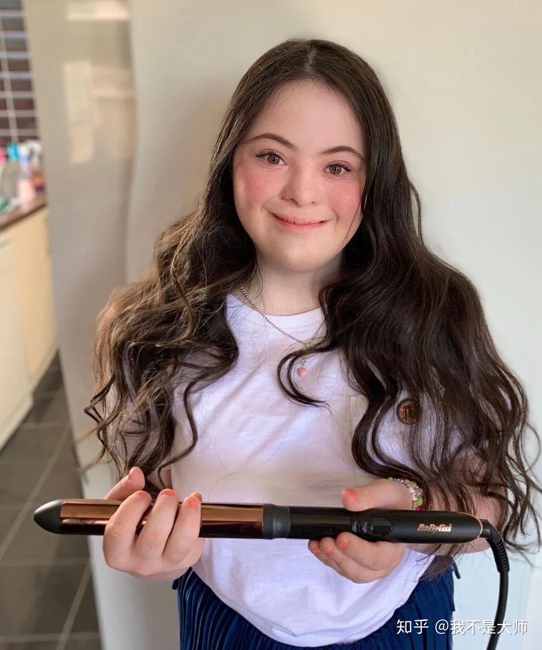 18岁的她成为史上首个登上vogue杂志的唐氏综合征患者还成为gucci时尚