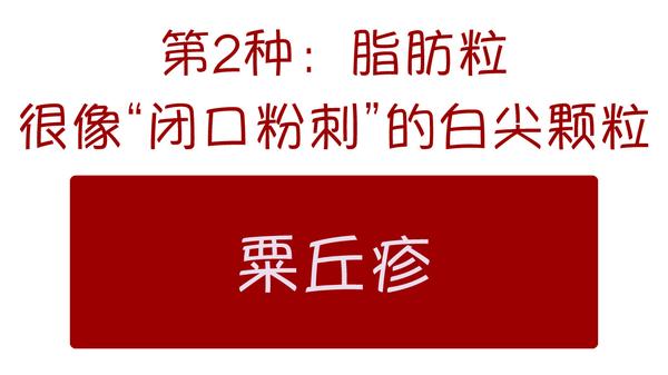 眼睛下脂肪粒是什么啊汗管瘤粟丘疹鸡皮肤毛周角化