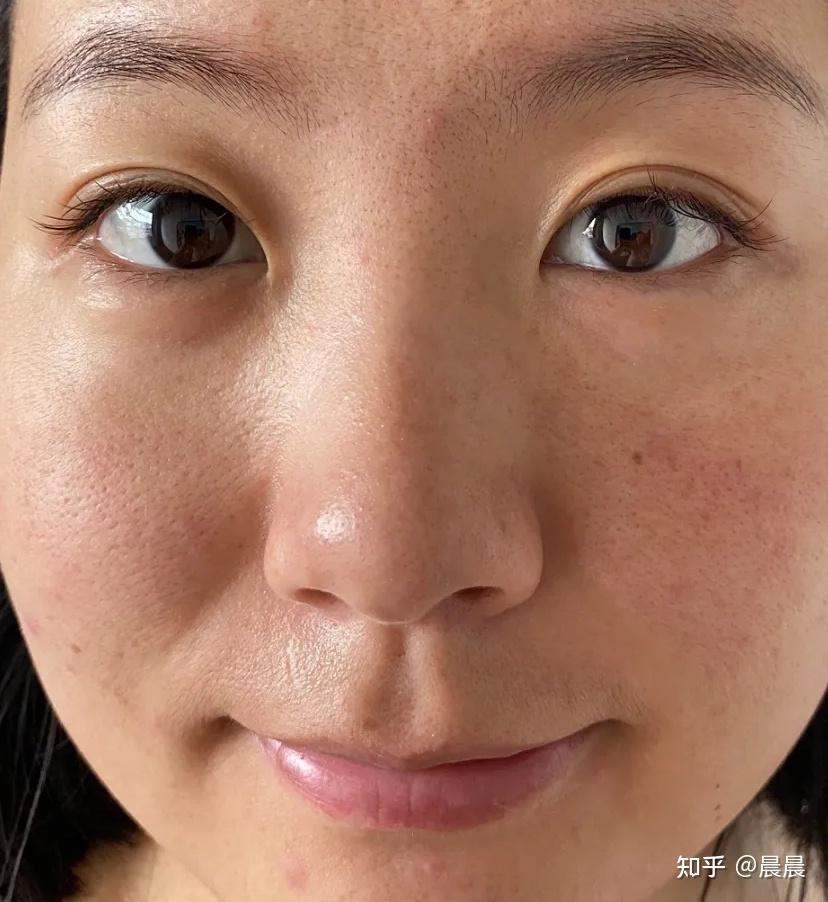 黄皮肤怎么有效美白?