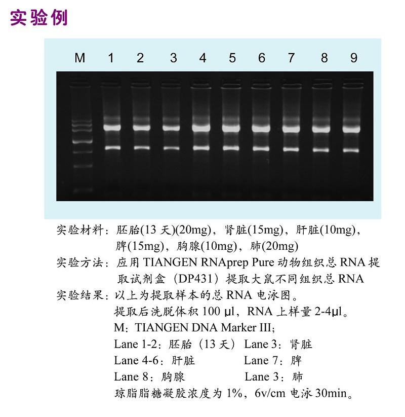 基因组DNA提取与质粒DNA提取有什么不同? - 知乎