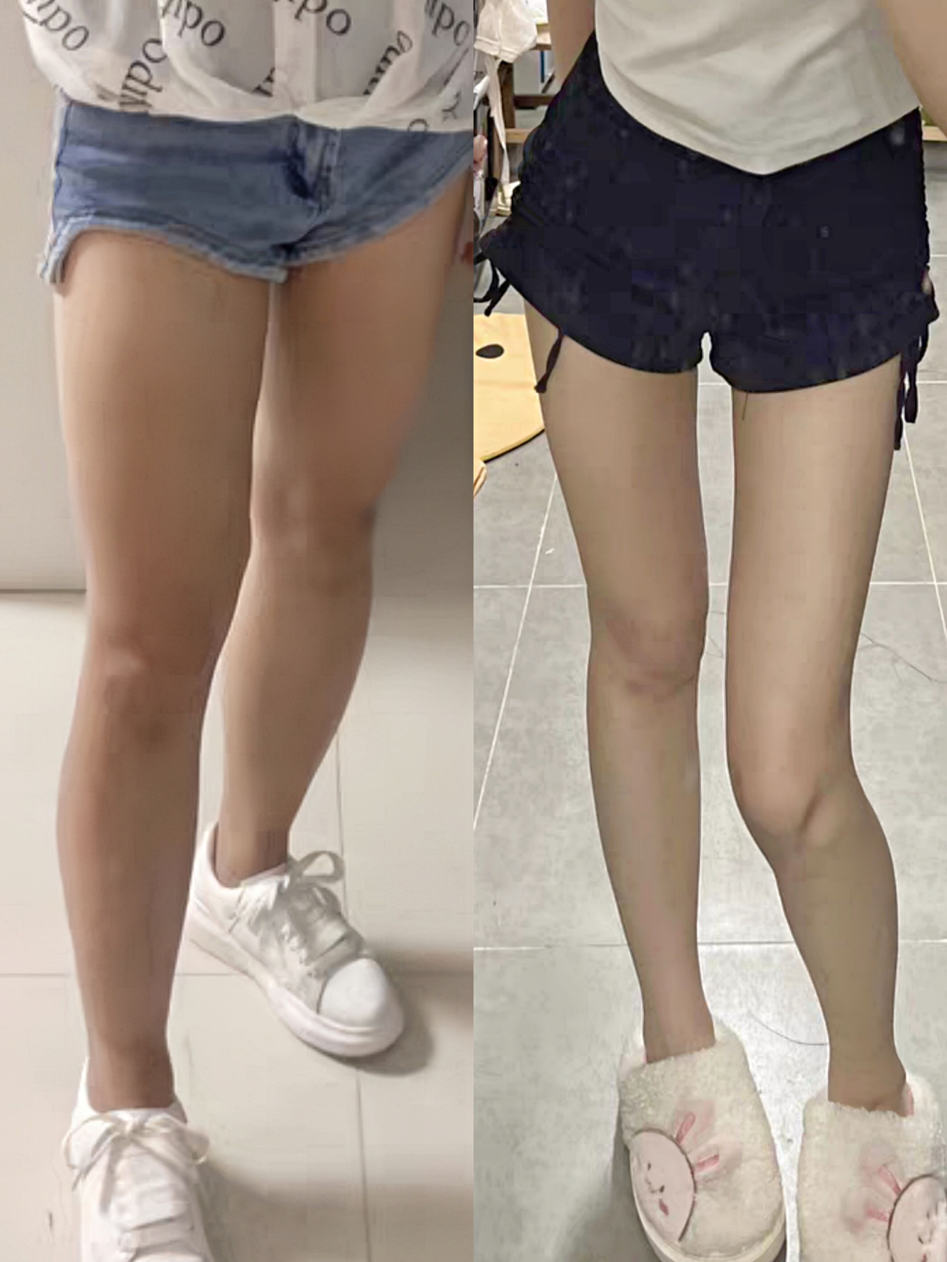 女生瘦腿前后对比照片图片