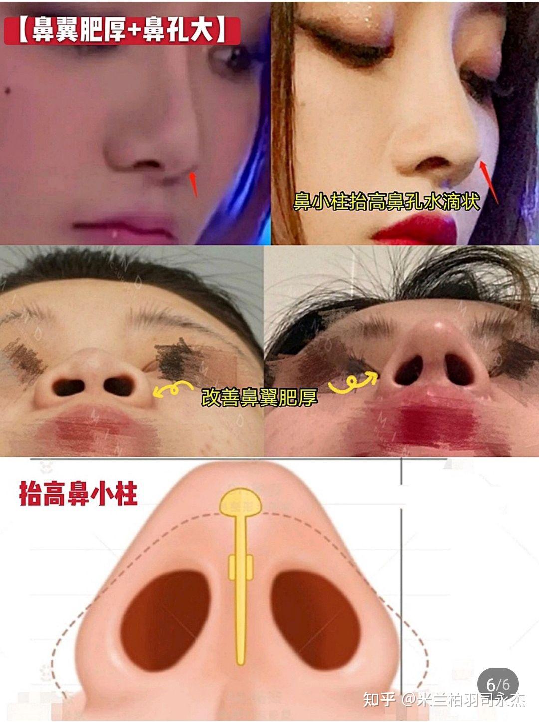 拯救大鼻头