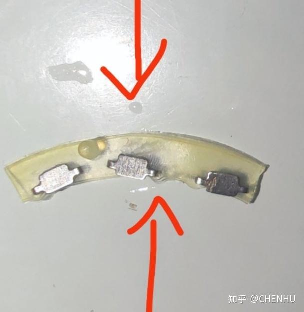 包皮拆钉超强攻略