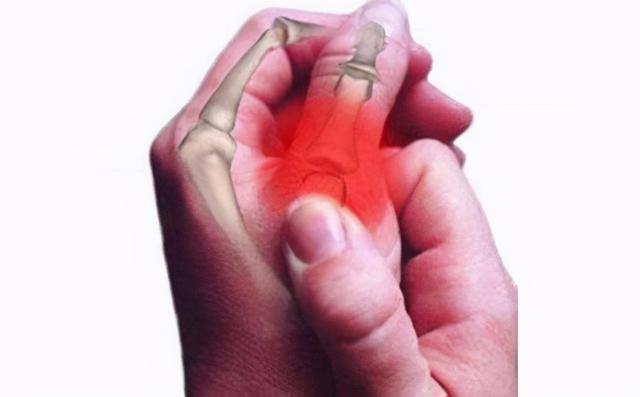 大拇指根部关节疼痛图片