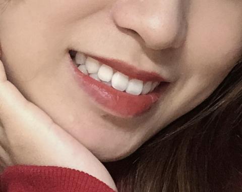 如图 俗称蝴蝶牙(名字针不戳!) 我从小