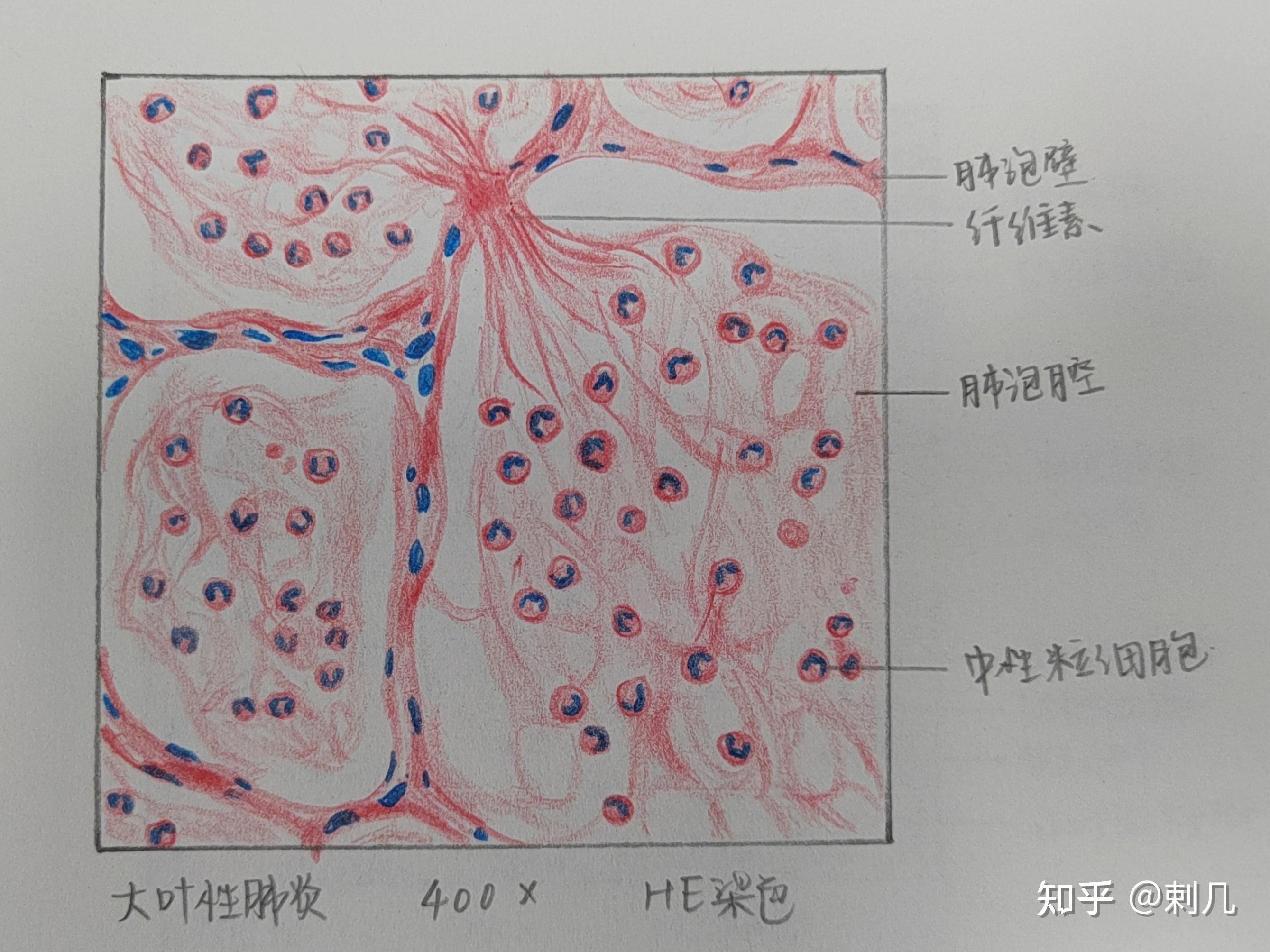 肺切片红蓝铅笔手绘图图片