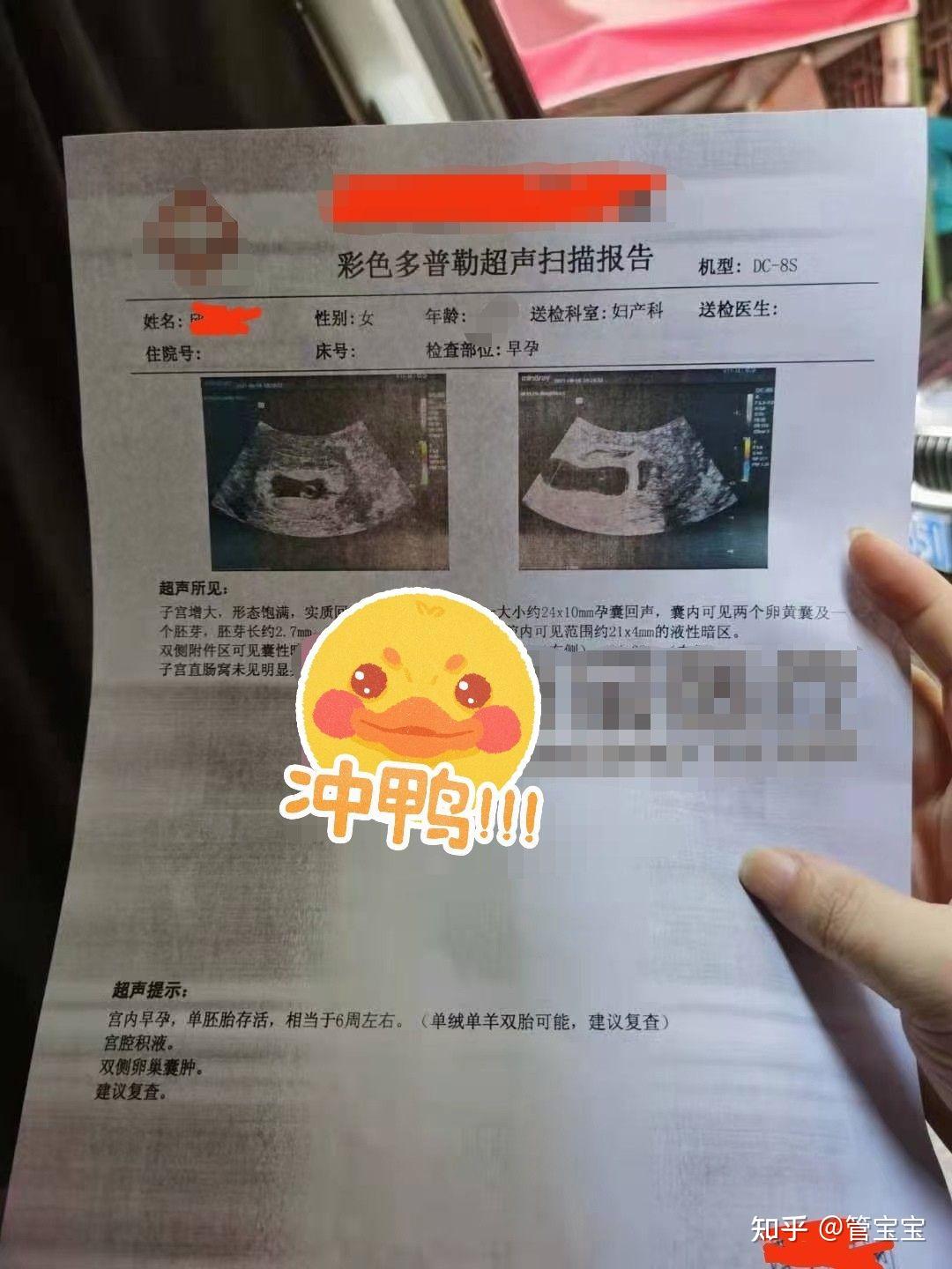 试管婴儿竟然同卵双胞胎？ - 知乎