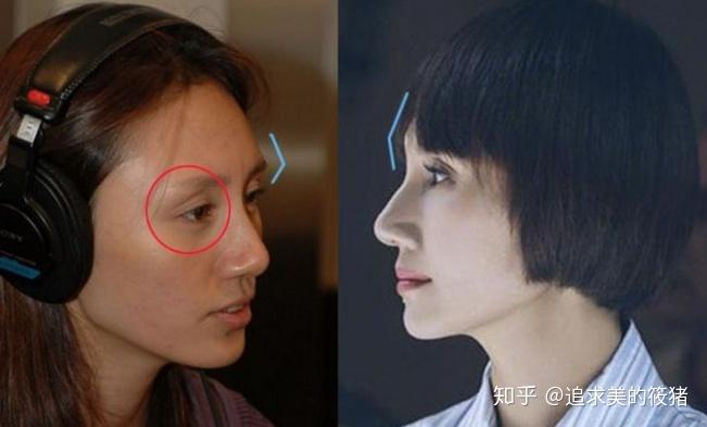 眉骨高不高呀