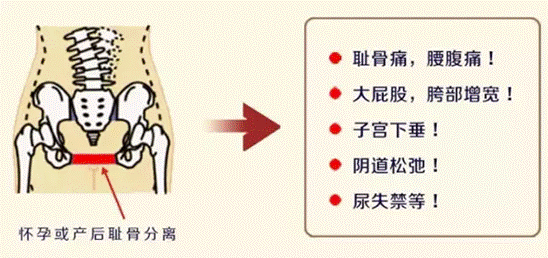 脊柱與脊椎骨盆骶dǐ骨髖kuān骨坐骨恥骨胯骨