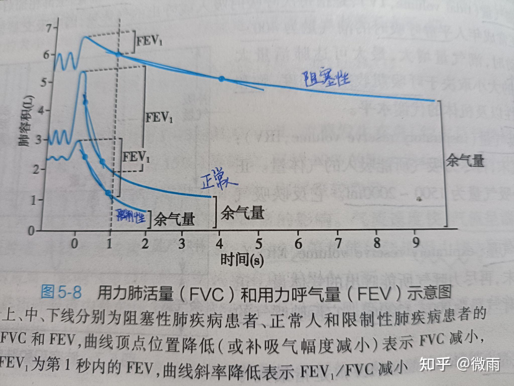 用力肺活量和用力呼出量图怎么理解