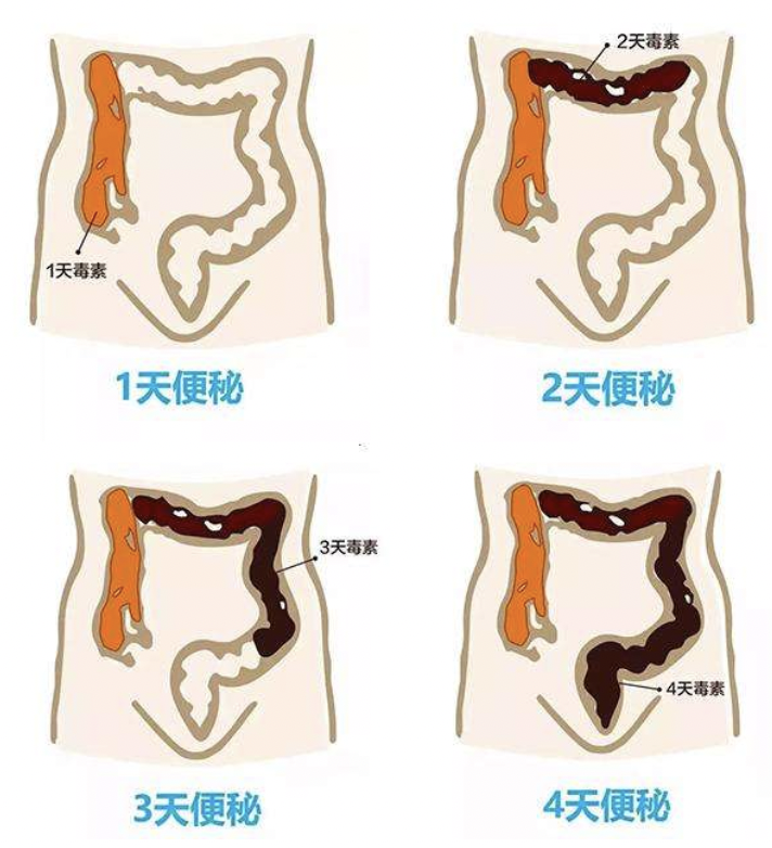 身体里的宿便不能及时排出去