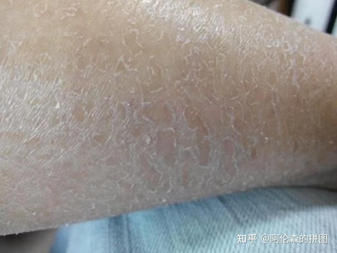 可以盲入的保湿身体乳，干鸡皮、鱼鳞皮女孩们看过来！ - 知乎