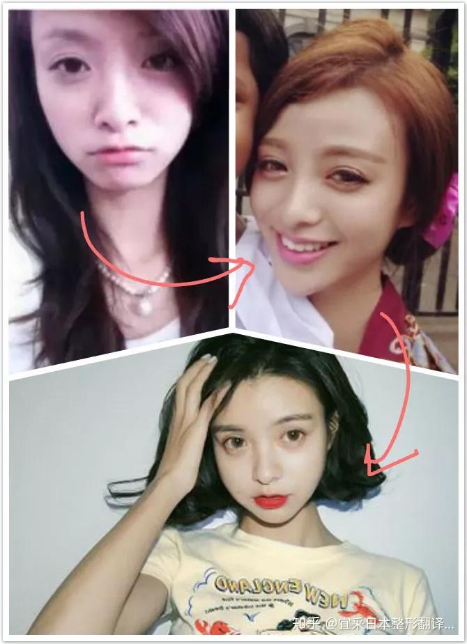 那个15岁就变成蛇精的女孩现在居然这么美