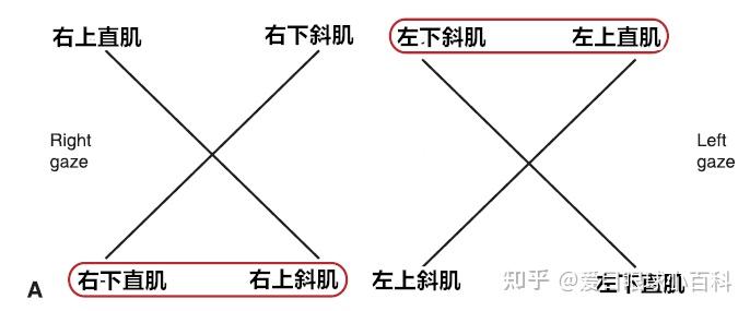 斜视的几种检查方法！ - 知乎