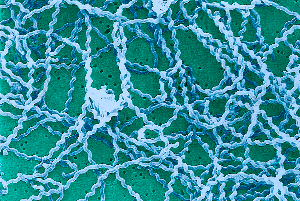 河南3人因蜱虫病病逝3人曾一同为去世感染者净身什