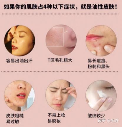 夏天到了,油皮男生怎么护肤?油皮护肤指南 - 知乎