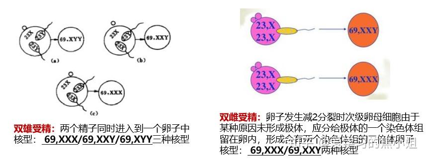 焦老师讲遗传系列之3:染色体数目异常 - 知乎