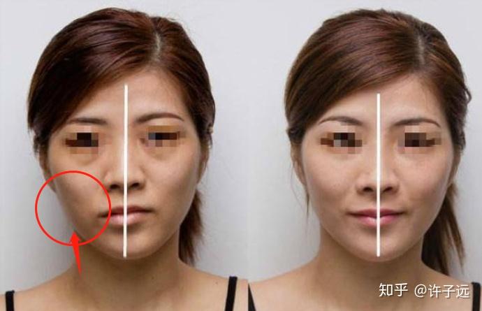 大小脸怎么调整,医美手段安全吗?