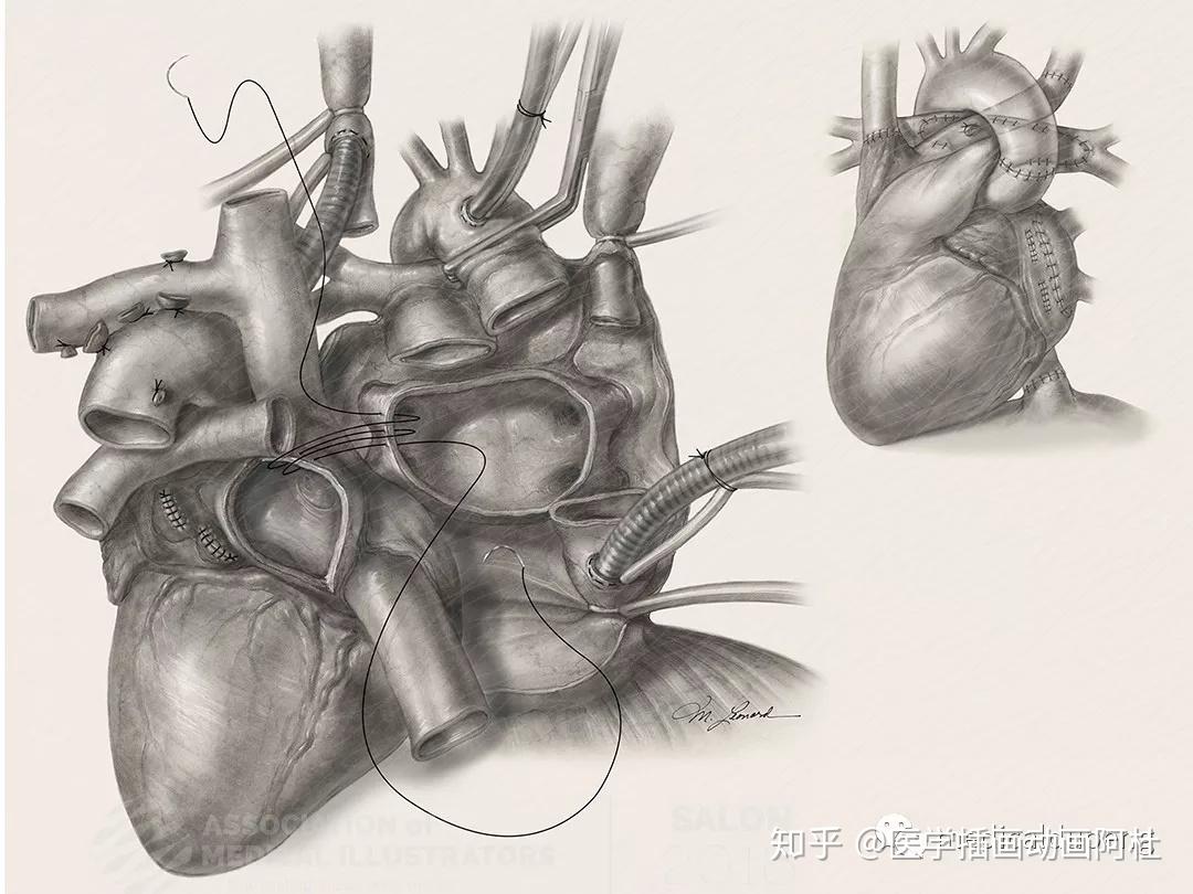 2018年美国医学插画协会ami沙龙展巡礼五十九